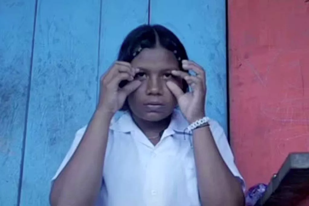 Talía, 15, fue atacada por los pelacaras.