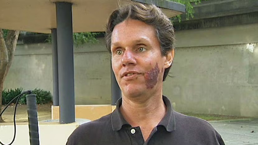 Daniel Kish 